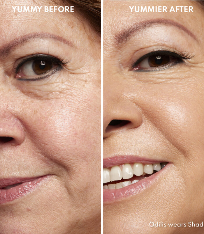 YS-SST_B+A YS-SST_B+A